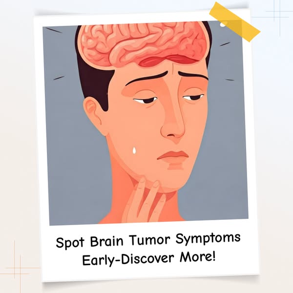Recognizing Early Signs of a Brain Tumor and Symptoms