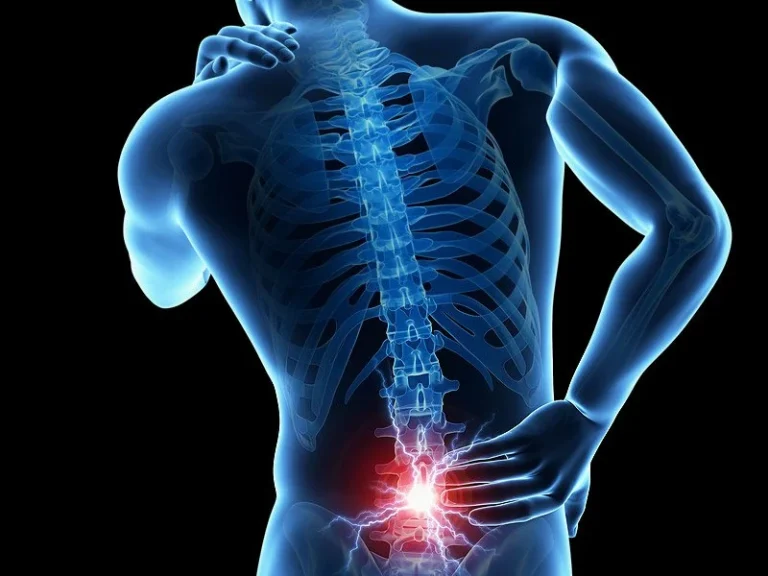 What Helps With Back Pain? Common Approaches Reviewed